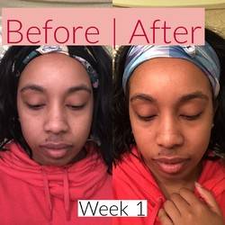 Is Drunk Elephant Babyfacial really better than K-beauty? US Formula vs. Korean Exfoliants