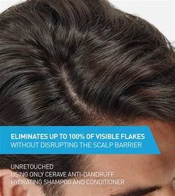 CeraVe US Anti-Dandruff vs. Local Scalp Care: The fastest path to a flake-free 2026